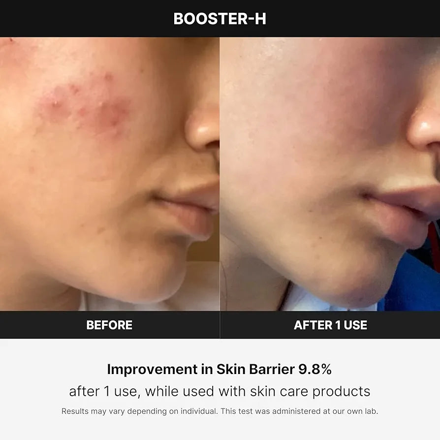 Medicube Age R Booster H Deive (Korean Skincare)