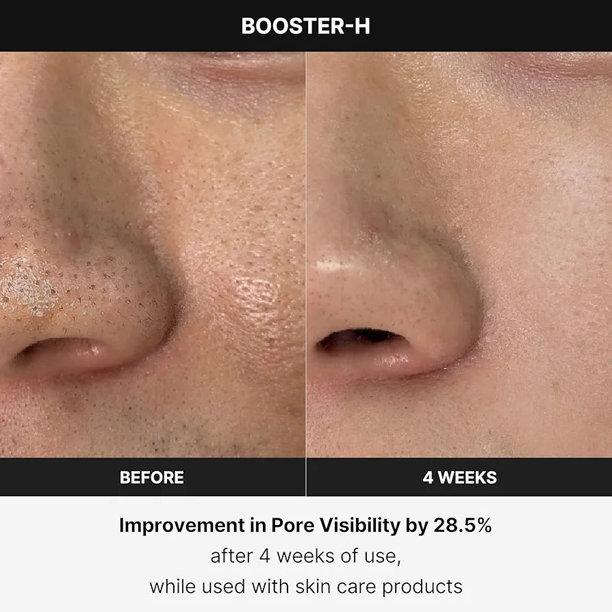 Medicube Age R Booster H Deive (Korean Skincare)