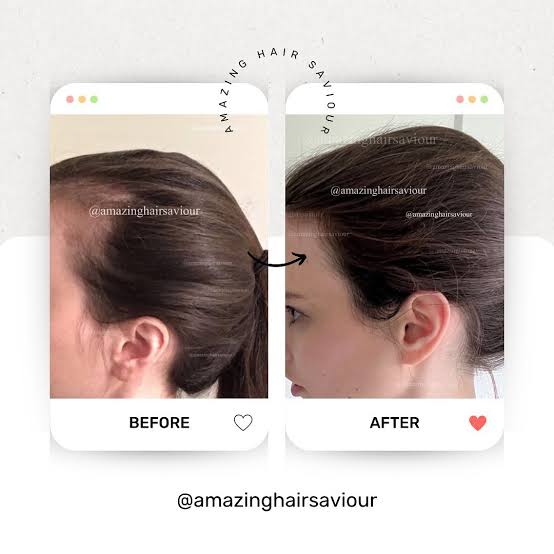 Amazing Hair Saviour Oil By Amber *Best Seller*