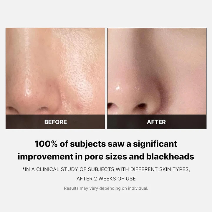 Medicube Zero Pore Pads 2.0, Dual-Textured Facial Toner Pads for Exfoliation and Pore Care with AHA Lactic Acid+ BHA Salicylic Acid, Ideal for All Skin Types, Korean Skin Care