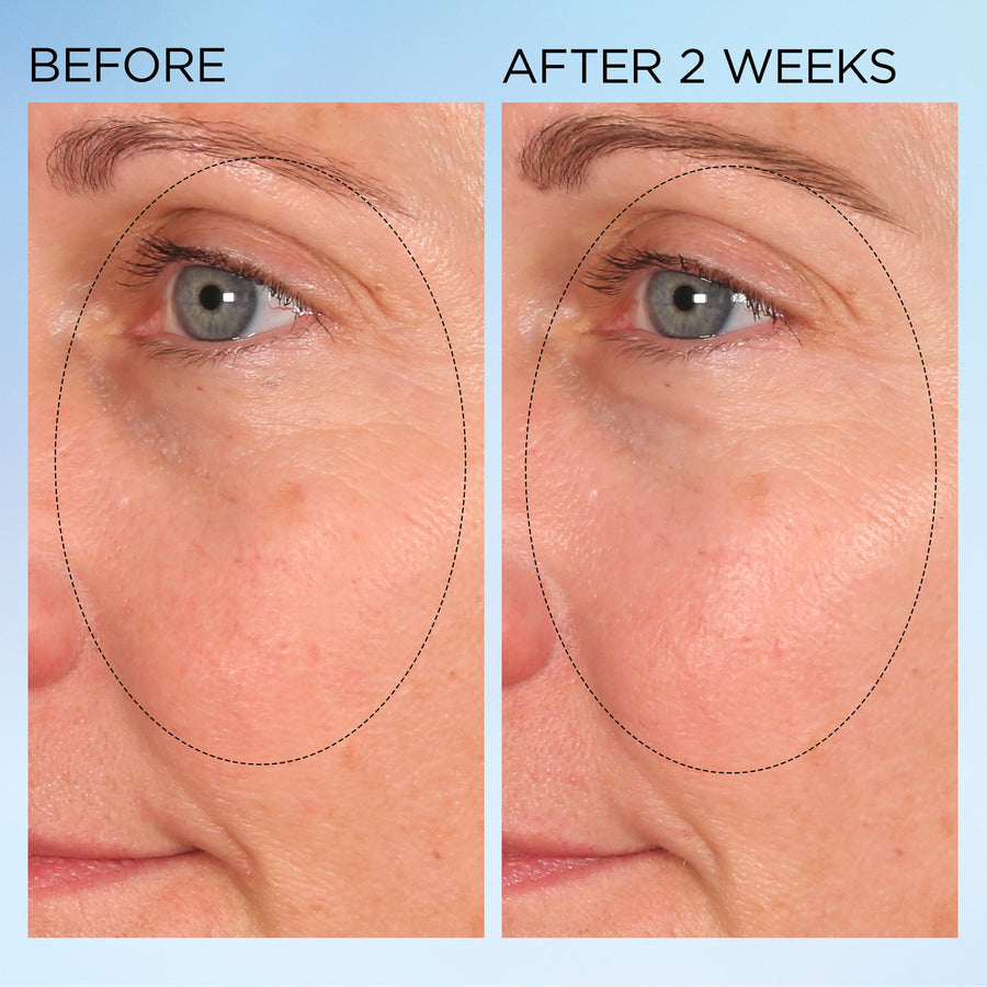 Elizabeth Arden Visible Brightening Clearly Radiant Spot Correcting Capsules