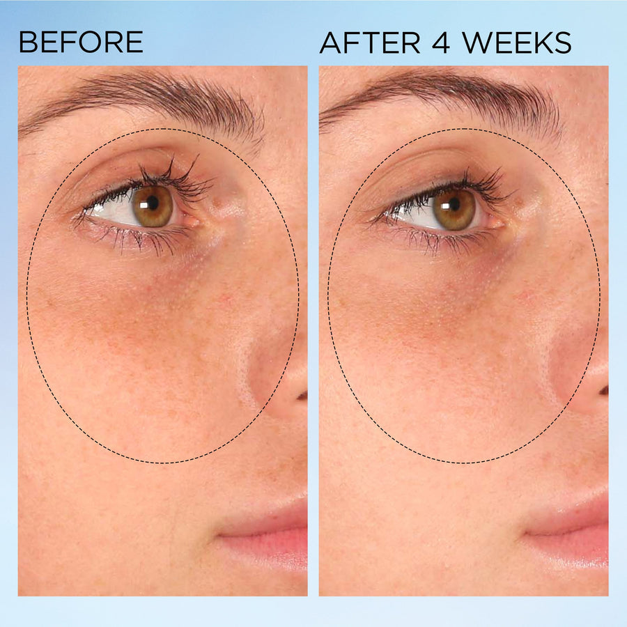 Elizabeth Arden Visible Brightening Clearly Radiant Spot Correcting Capsules