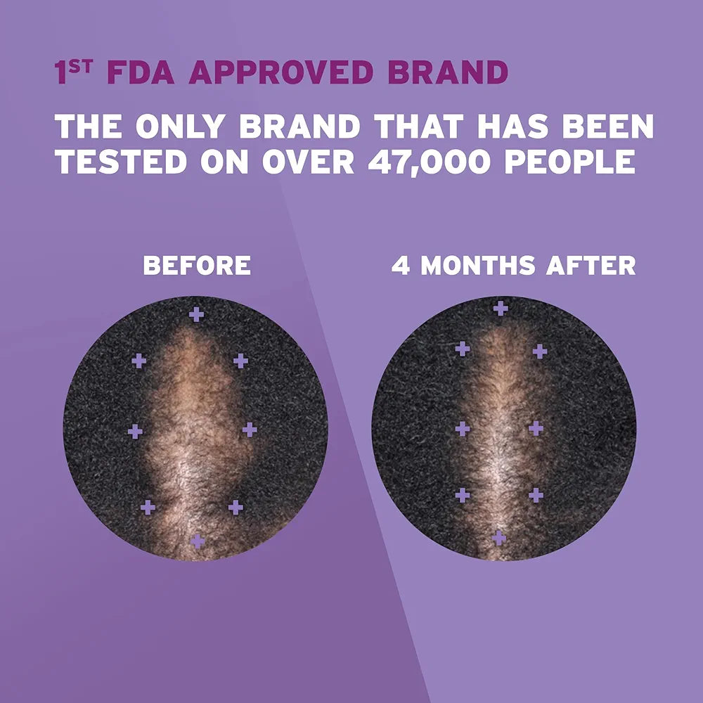 Rogaine 5% Minoxidil for Women n Foam, Clinically Proven Regrowth Hair Loss Treatment 4-Month Suppl