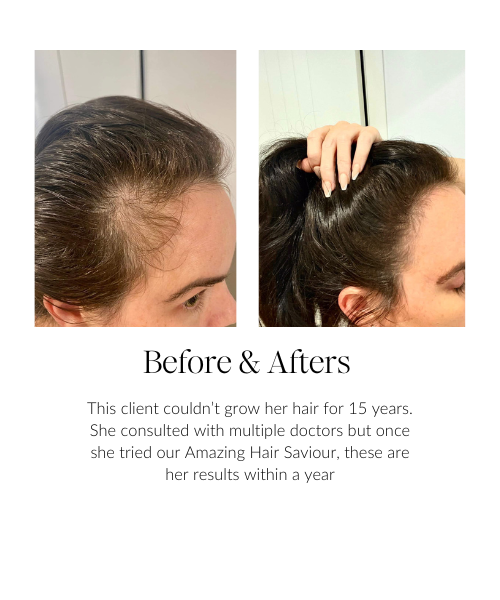 Amazing Hair Saviour Oil By Amber *Best Seller*