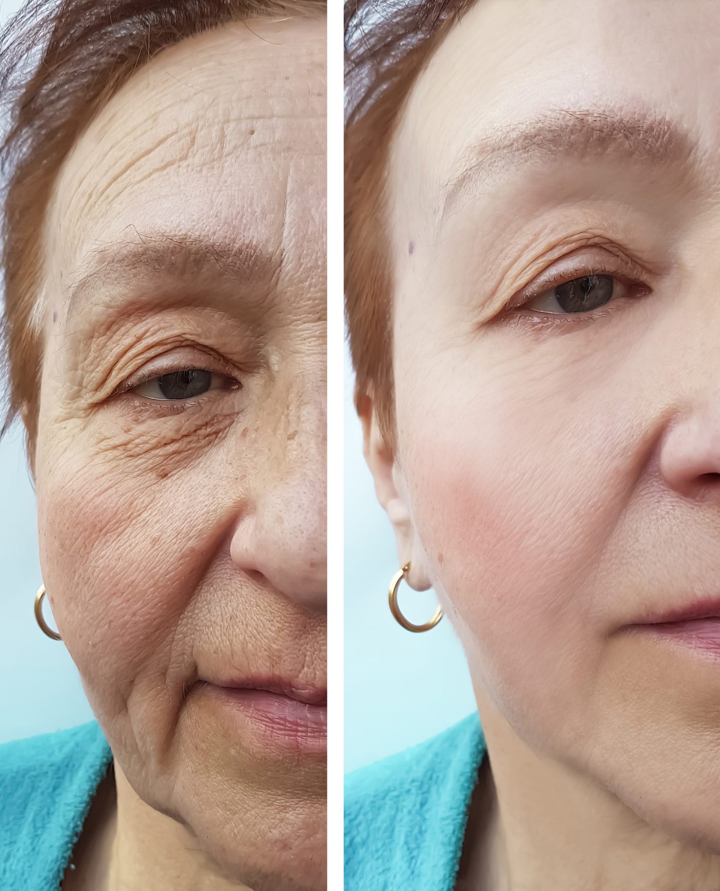 Aceology Firming Peptide Hydrogel Mask