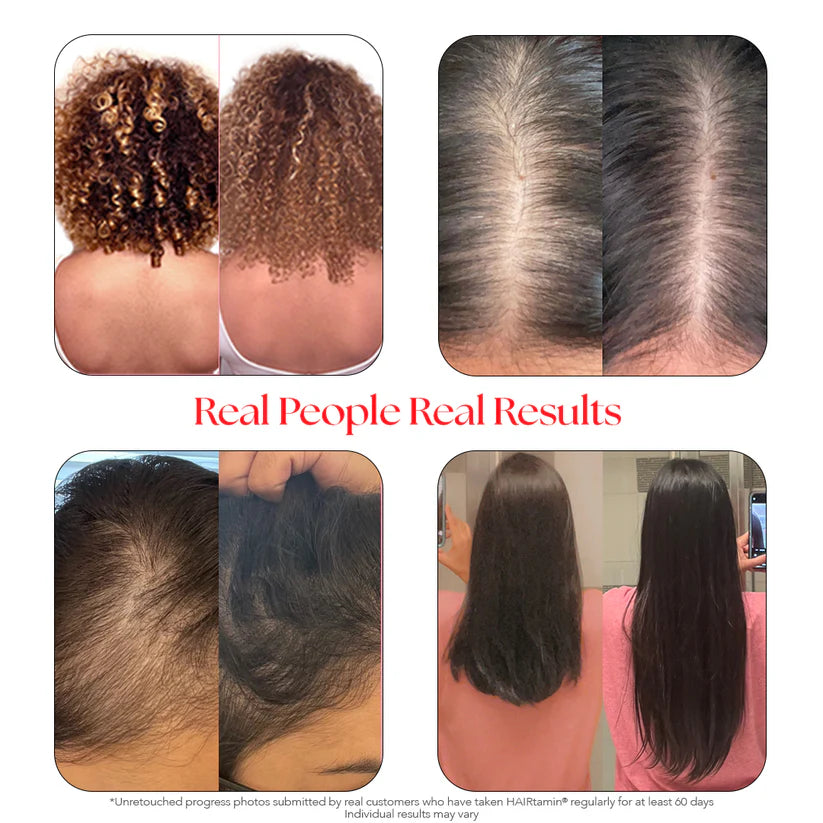 HAIRtamin Advanced Formula Hair Vitamin.  Promotes Fast Hiar Growth