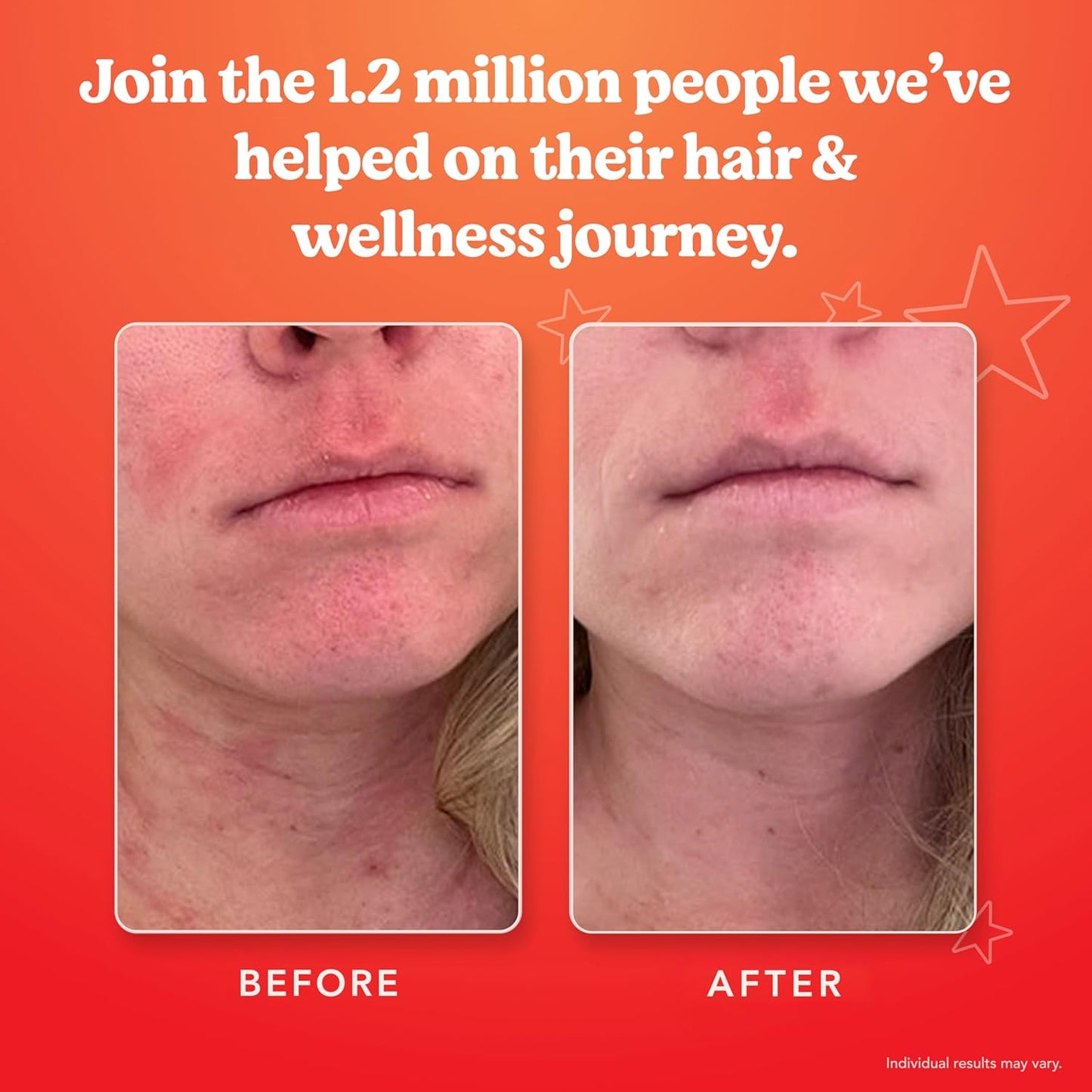 SKINTAMIN Vitamin  & Collagen for Skin
